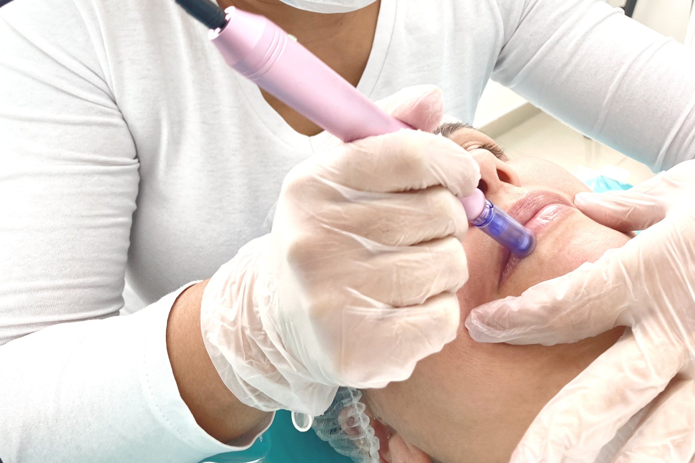 Tratamento de volume labial